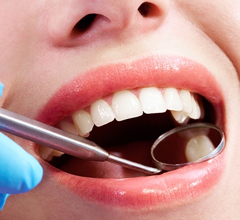 Dentist checking patient's tooth colored filling after restorative dentistry