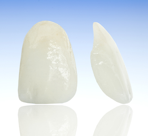 Model porcelain veneers options for cosmetic dentistry treatment
