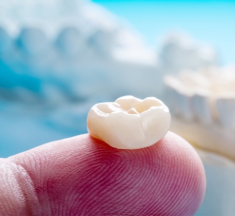 Metal free dental crown resting on a fingertip