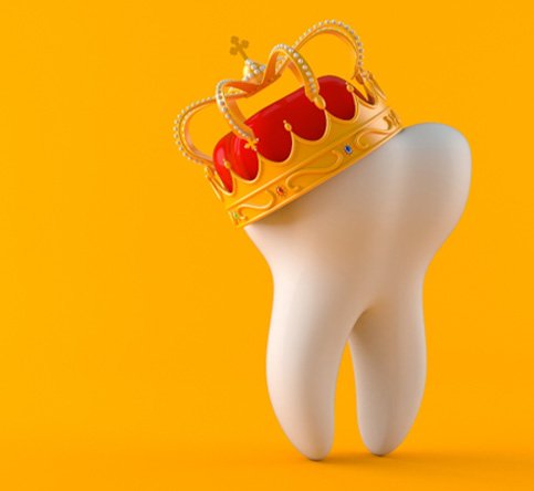 Digital illustration of tooth wearing crown