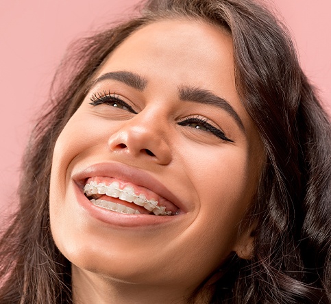 Woman smiling with Six Month Smiles braces in place