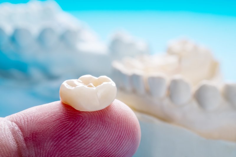 example of a dental crown in Clearwater & Tampa