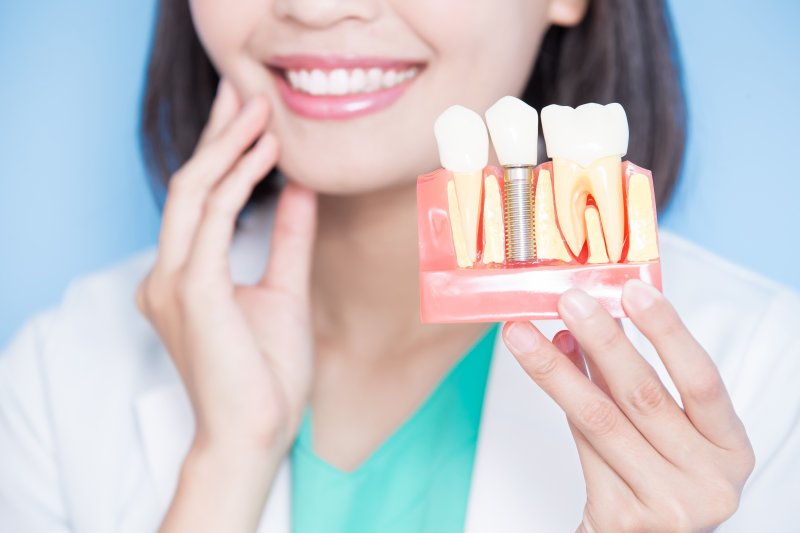 A model illustrating how long dental implants last