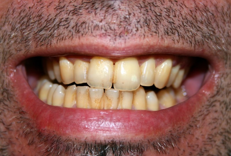 Close-up of a yellow smile